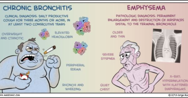 A challenge to the seven widely believed concepts of COPD