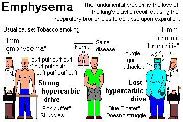 Chronic Obstructive Pulmonary Disease Today on Medscape